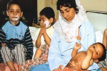 Bagheri remembers victims of Sardasht chemical bombing